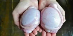 خواص دنبلان برای مردان و زنان در طب سنتی مدرن